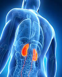 Kidney Disease Image